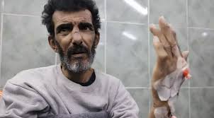 سياسة إسرائيل التجويع حتى الموت